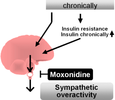 Chronically raised caloric intake and sympathetic overactivity